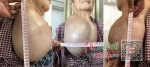 5公斤重甲状腺肿瘤2小时成功切除（图） - 中国江西网